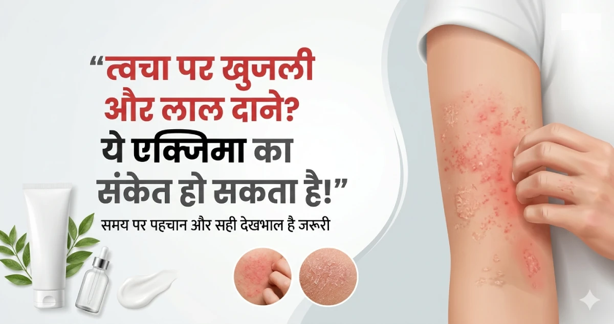 त्वचा-पर-खुजली-और-लाल-दाने-ये-एक्जिमा-का-संकेत-हो-सकता-है